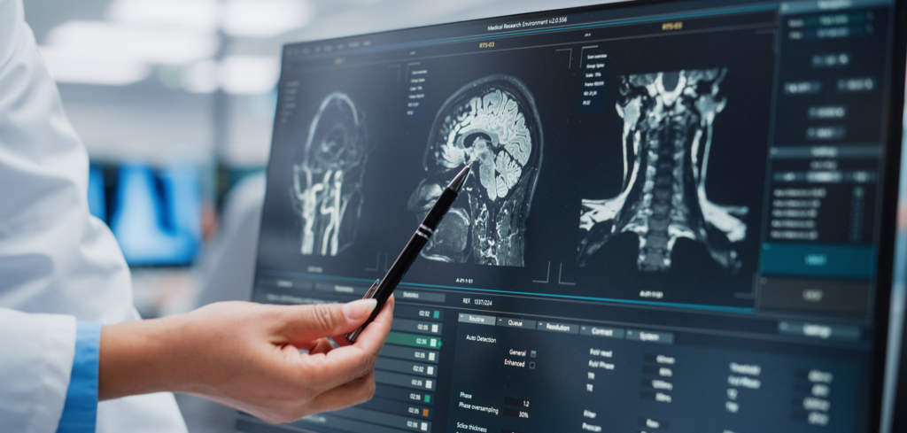 Doctor pointing to brain scan, post concussion syndrome