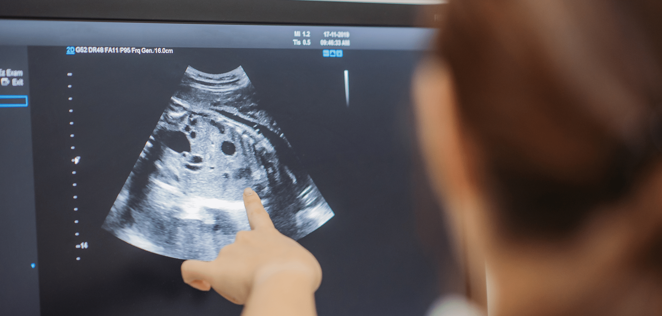 Pointing at an ultrasound