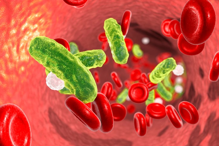 Sepsis, bacteria in blood